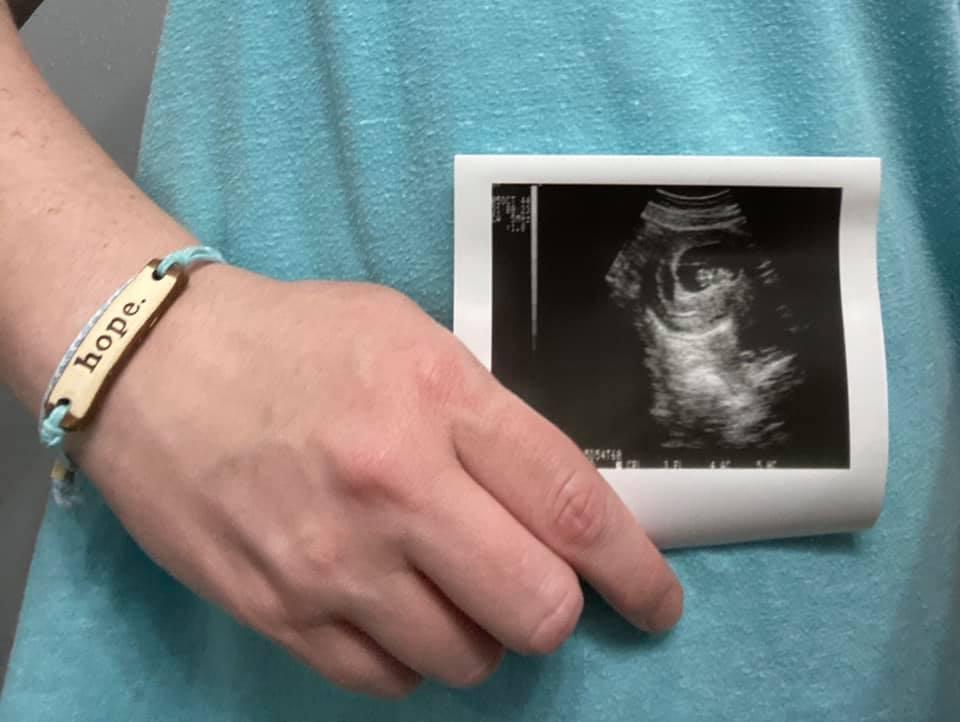 My Story of Infertility - MudLOVE